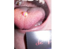 Derapage Corporel Piercing