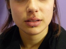 Médusa (haut), labret (bas)